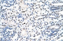 Invitrogen Nuclear Matrix Protein p84 Polyclonal Antibody 100 &mu;L | Buy Online | Invitrogen&trade; | Fisher Scientific