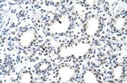 Invitrogen Nuclear Matrix Protein p84 Polyclonal Antibody 100 &mu;L | Buy Online | Invitrogen&trade; | Fisher Scientific