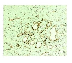 Invitrogen Nuclear Matrix Protein p84 Polyclonal Antibody 100 &mu;L | Buy Online | Invitrogen&trade; | Fisher Scientific