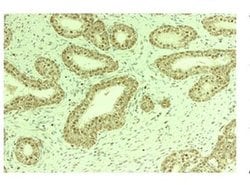 Invitrogen Nuclear Matrix Protein p84 Polyclonal Antibody 100 &mu;L | Buy Online | Invitrogen&trade; | Fisher Scientific