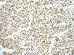 Invitrogen LSM4 Polyclonal Antibody 100 &mu;L | Buy Online | Invitrogen&trade; | Fisher Scientific