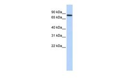Invitrogen ADARB2 Polyclonal Antibody 100 &mu;L; Unconjugated:Antibodies,