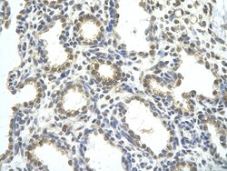 Invitrogen RBM26 Polyclonal Antibody 100 &mu;L; Unconjugated:Antibodies,