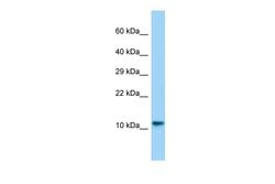 Invitrogen Lsm10 Polyclonal Antibody 100 &mu;L; Unconjugated:Antibodies,