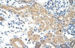 Invitrogen NXF5 Polyclonal Antibody 100 &mu;L; Unconjugated:Antibodies,