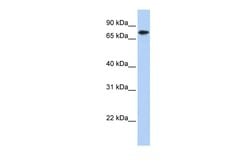 Invitrogen KLHL23 Polyclonal Antibody 100 &mu;L; Unconjugated:Antibodies,