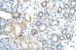 Invitrogen RBM46 Polyclonal Antibody 100 &mu;L; Unconjugated:Antibodies,