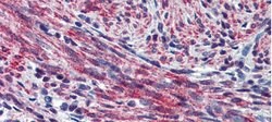 Invitrogen Periostin Polyclonal Antibody 100 &mu;L; Unconjugated:Antibodies,