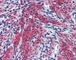 Invitrogen Periostin Polyclonal Antibody 100 &mu;L; Unconjugated:Antibodies,