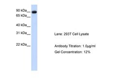 Invitrogen Periostin Polyclonal Antibody 100 &mu;L; Unconjugated:Antibodies,