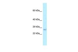Invitrogen EVA1B Polyclonal Antibody 100 &mu;L; Unconjugated:Antibodies,