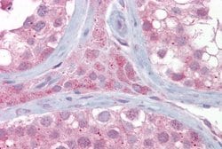 Invitrogen UBE2L3 Polyclonal Antibody 100 &mu;L; Unconjugated:Antibodies,