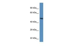 Invitrogen RNF92 Polyclonal Antibody 100 &mu;L; Unconjugated:Antibodies,