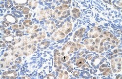 Invitrogen LOC342293 Polyclonal Antibody 100 &mu;L | Buy Online | Invitrogen&trade; | Fisher Scientific