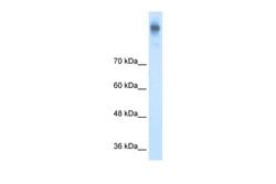Invitrogen NKCC1 Polyclonal Antibody 100 &mu;L; Unconjugated:Antibodies,