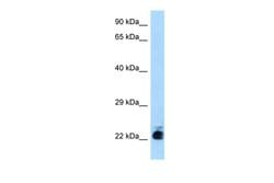Invitrogen CTR1 Polyclonal Antibody 100 &mu;L; Unconjugated:Antibodies,