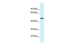 Invitrogen SLC1A4 Polyclonal Antibody 100 &mu;L | Buy Online | Invitrogen&trade; | Fisher Scientific