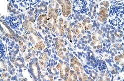 Invitrogen ALDH3A2 Polyclonal Antibody 100 &mu;L; Unconjugated:Antibodies,