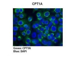 Invitrogen CPT1A Polyclonal Antibody 100 &mu;L; Unconjugated:Antibodies,