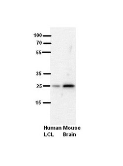 Invitrogen SH3BGR Polyclonal Antibody 100 &mu;L; Unconjugated:Antibodies,