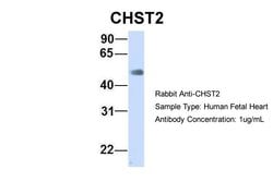 Invitrogen CHST2 Polyclonal Antibody 100 &mu;L | Buy Online | Invitrogen&trade; | Fisher Scientific