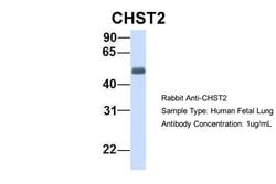 Invitrogen CHST2 Polyclonal Antibody 100 &mu;L | Buy Online | Invitrogen&trade; | Fisher Scientific