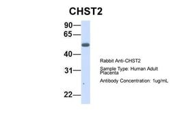 Invitrogen CHST2 Polyclonal Antibody 100 &mu;L | Buy Online | Invitrogen&trade; | Fisher Scientific