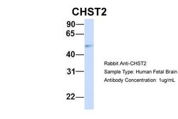Invitrogen CHST2 Polyclonal Antibody 100 &mu;L | Buy Online | Invitrogen&trade; | Fisher Scientific
