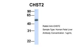 Invitrogen CHST2 Polyclonal Antibody 100 &mu;L | Buy Online | Invitrogen&trade; | Fisher Scientific