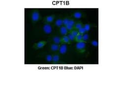 Invitrogen CPT1B Polyclonal Antibody 100 &mu;L; Unconjugated:Antibodies,