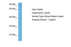 Invitrogen CPT1B Polyclonal Antibody 100 &mu;L; Unconjugated:Antibodies,