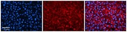 Invitrogen TSPAN31 Polyclonal Antibody 100 &mu;L; Unconjugated:Antibodies,
