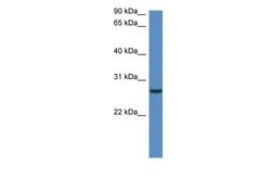 Invitrogen CLEC1B Polyclonal Antibody 100 &mu;L; Unconjugated:Antibodies,