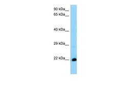 C8orf55 Polyclonal Antibody, Invitrogen 100 &mu;L; Unconjugated:Antibodies,