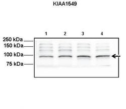 Invitrogen KIAA1549 Polyclonal Antibody 100 &mu;L; Unconjugated:Antibodies,