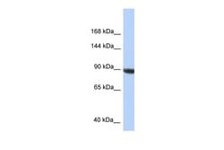 Invitrogen KIAA1549 Polyclonal Antibody 100 &mu;L; Unconjugated:Antibodies,