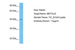 Invitrogen METTL22 Polyclonal Antibody 100 &mu;L; Unconjugated:Antibodies,