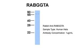 Invitrogen RABGGTA Polyclonal Antibody 100 &mu;L; Unconjugated:Antibodies,