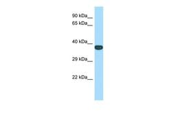 Invitrogen TMEM165 Polyclonal Antibody 100 &mu;L; Unconjugated:Antibodies,
