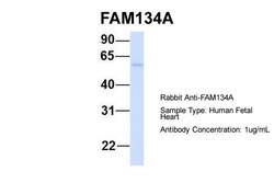 Invitrogen FAM134A Polyclonal Antibody 100 μL; Unconjugated:Antibodies,