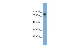 Invitrogen ZNF599 Polyclonal Antibody 100 &mu;L; Unconjugated:Antibodies,