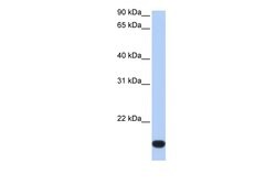Invitrogen ZNF826P Polyclonal Antibody 100 &mu;L; Unconjugated:Antibodies,