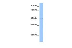 Invitrogen ZNF385D Polyclonal Antibody 100 &mu;L; Unconjugated:Antibodies,