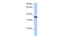 Invitrogen ZNF192P1 Polyclonal Antibody 100 &mu;L; Unconjugated:Antibodies,