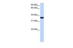 Invitrogen TP53I13 Polyclonal Antibody 100 &mu;L; Unconjugated:Antibodies,