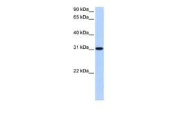 Invitrogen TNRC18B Polyclonal Antibody 100 &mu;L; Unconjugated:Antibodies,