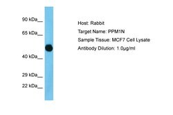 PPM1N Polyclonal Antibody:Antibodies, Polyclonal