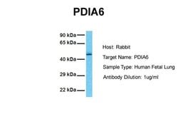 Invitrogen PDIA6 Polyclonal Antibody 100 &mu;L; Unconjugated:Antibodies,