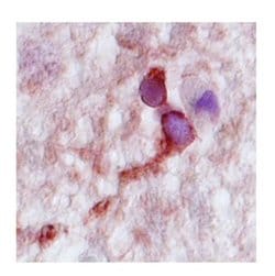 CPLX2 Polyclonal Antibody 100 &mu;L | Buy Online | Invitrogen | Fisher Scientific