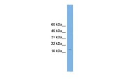 CPLX2 Polyclonal Antibody 100 &mu;L | Buy Online | Invitrogen | Fisher Scientific